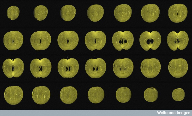 Illustration for article titled This Is How Your Fruits and Vegetables Look in an MRI Machine